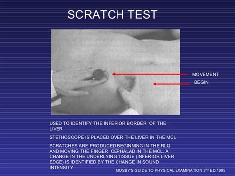 liver and ascites scratch test